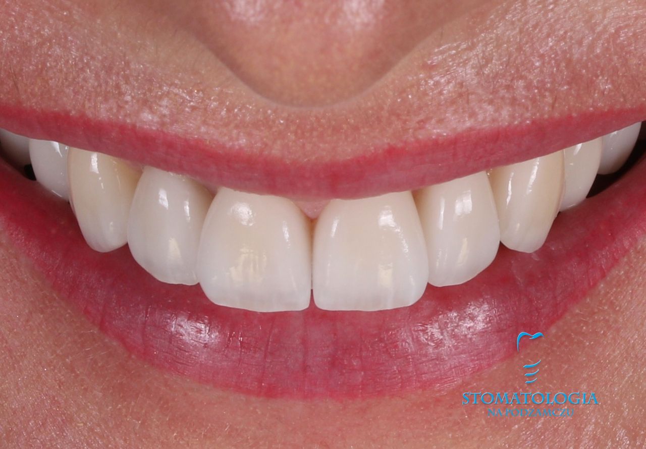 Katarzyna Matuszak-Burkowska-10