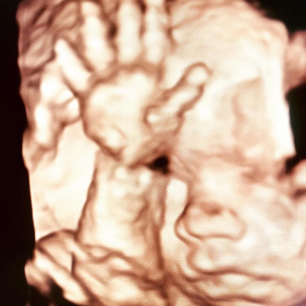 Dilek Turğut Kestane-16