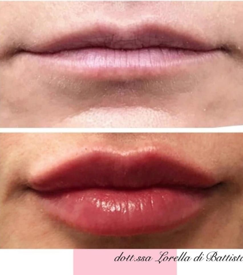 Lorella Di Battista-7