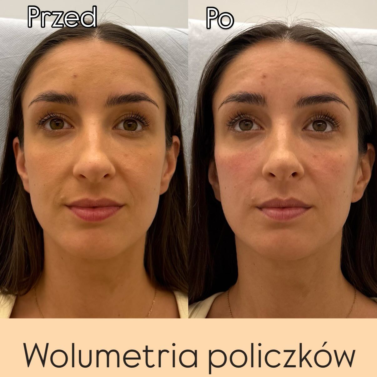 Aleksandra Kowalczuk-43