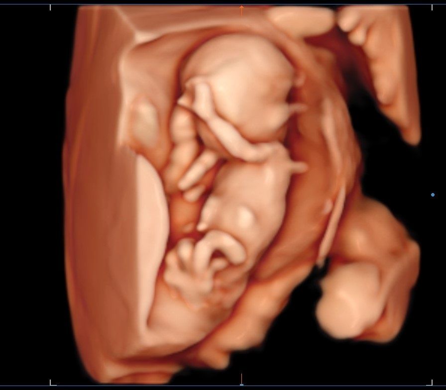 Valentina Conserva-5