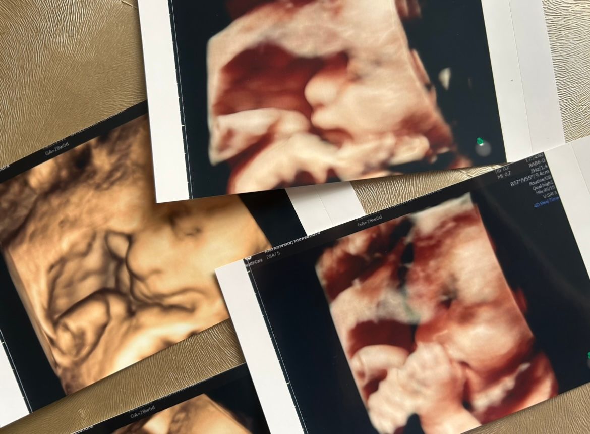 Wioletta Rozmus-Warcholińska-132