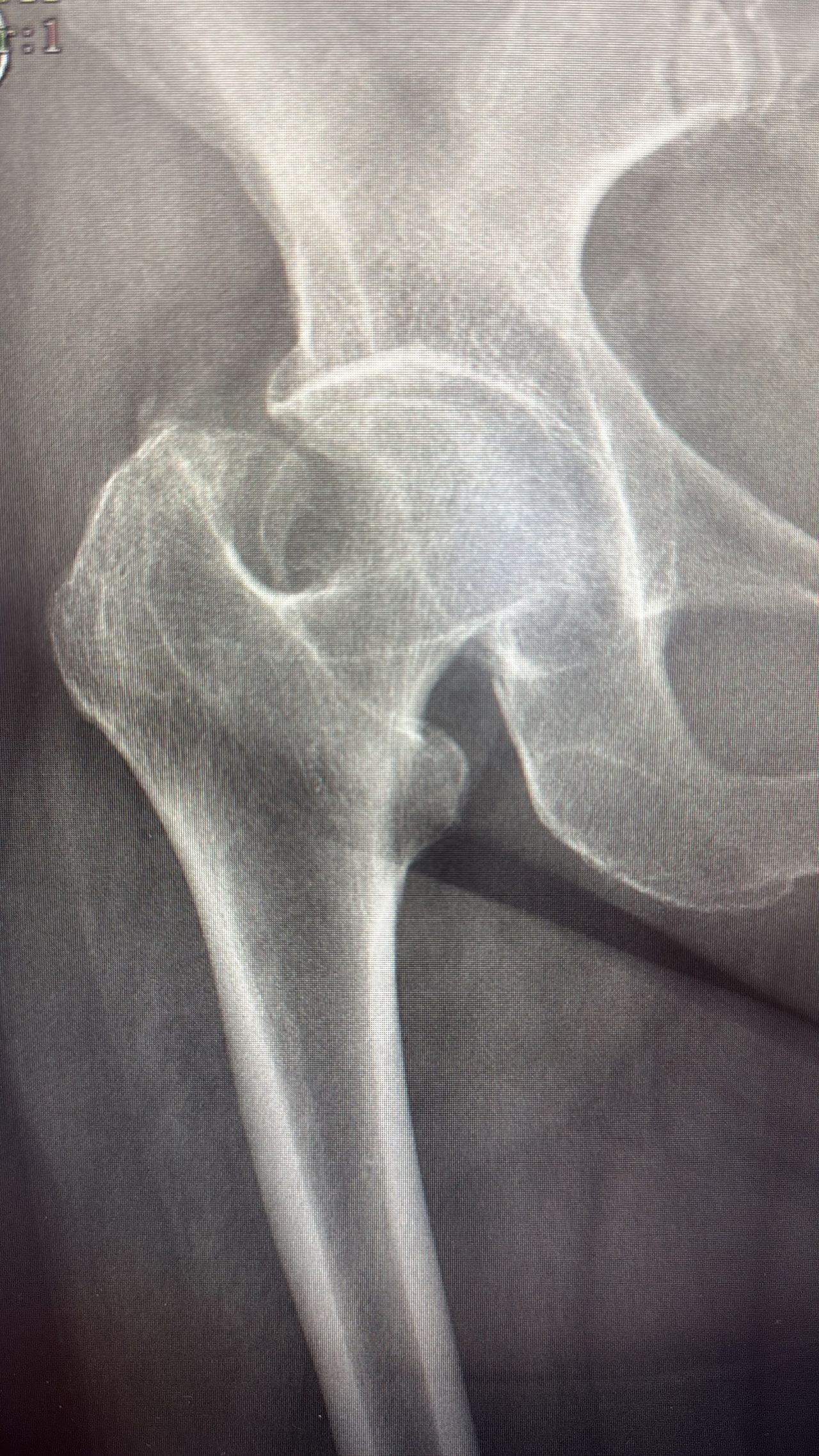 Pieralberto Valpiana-4