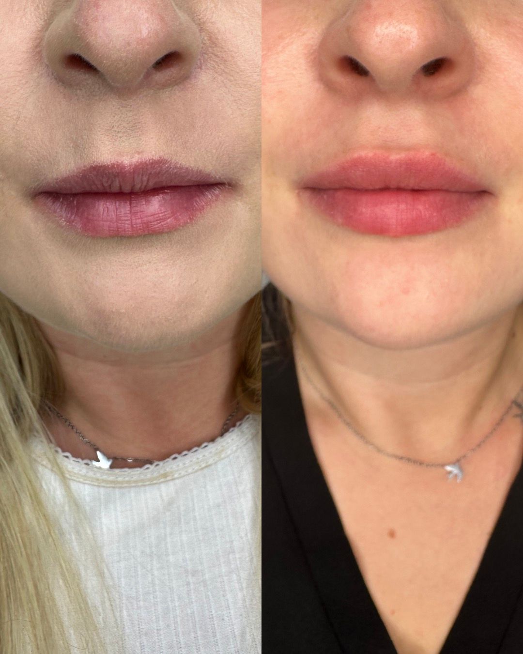 Michalina Zagańczyk-Bączek-19