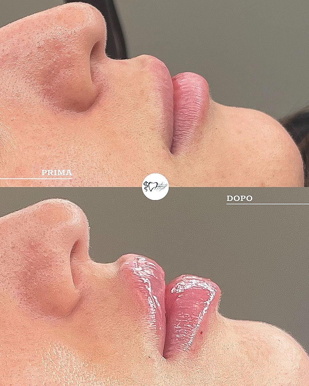 Alessandro Donzelli-3