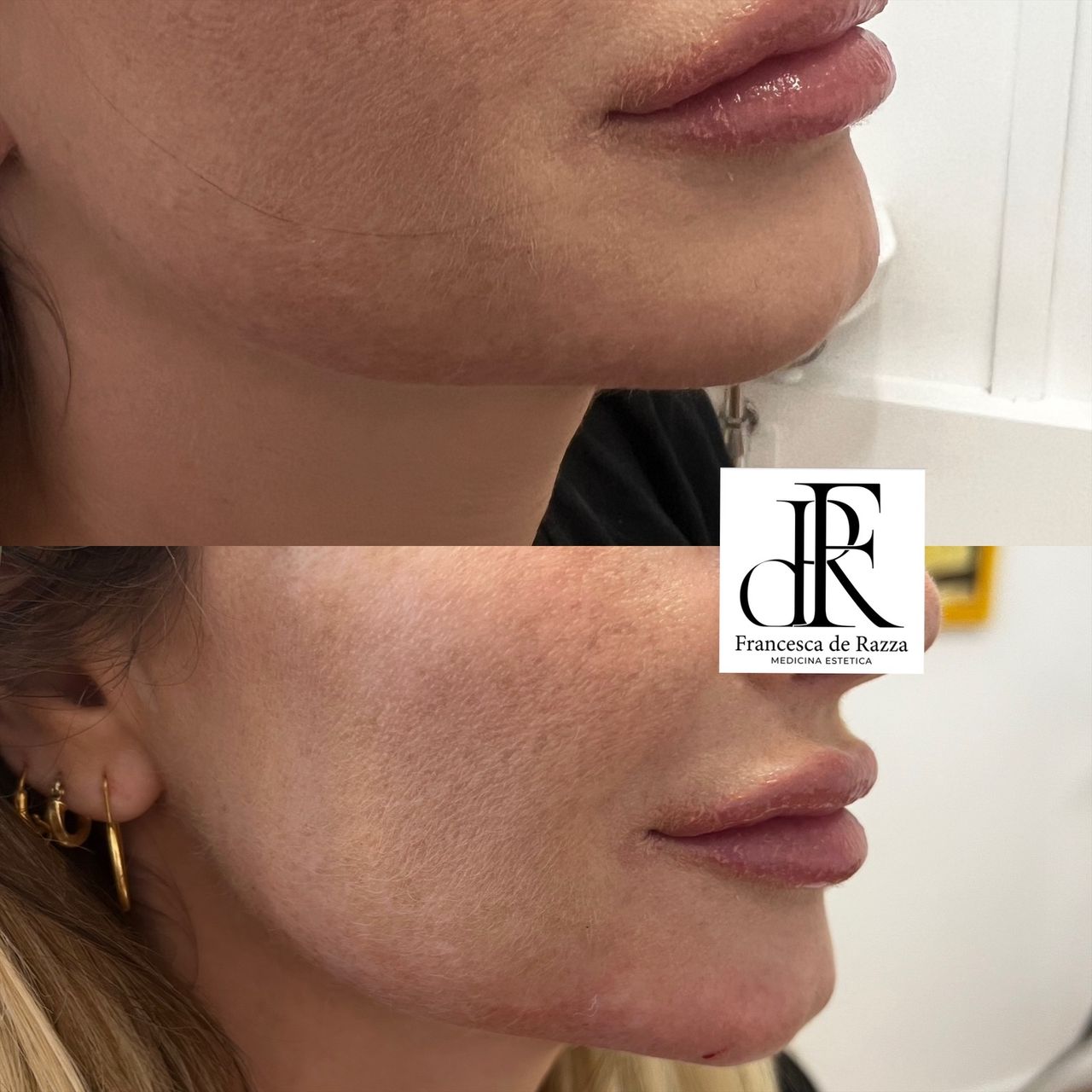 Francesca De Razza-66