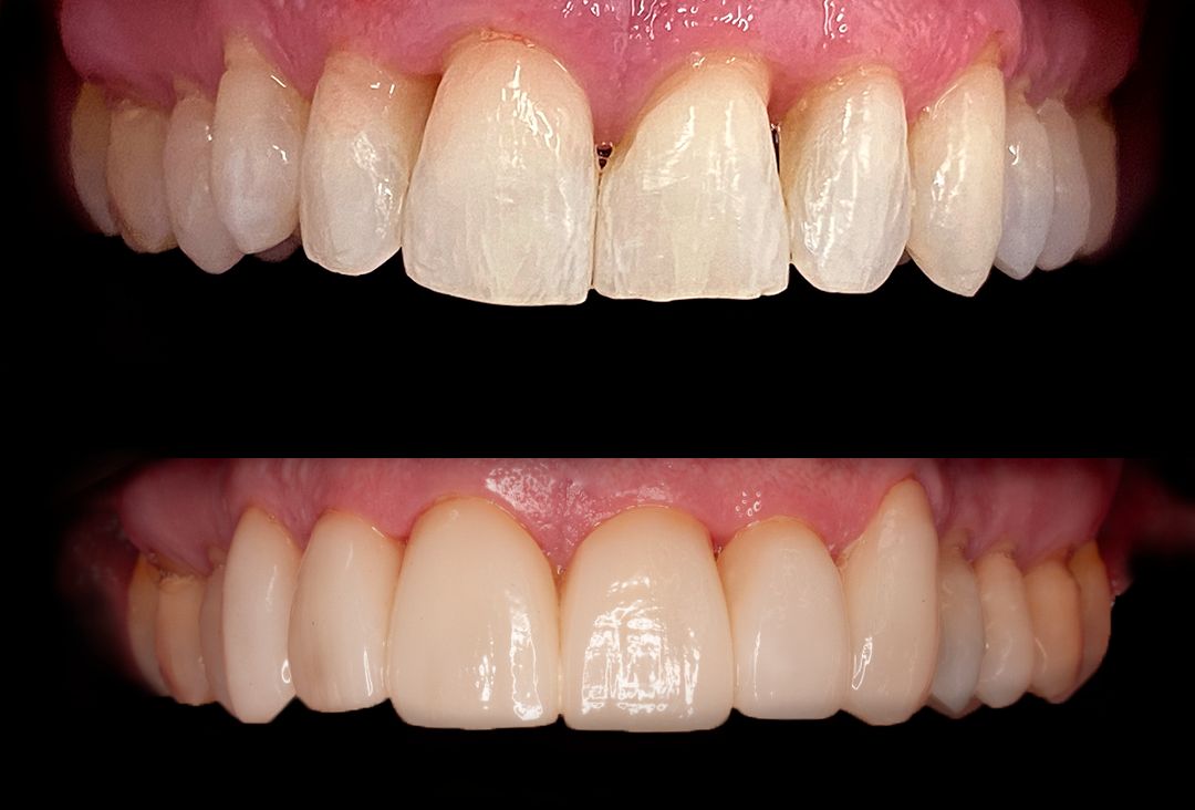 Marien Morata Roig-16