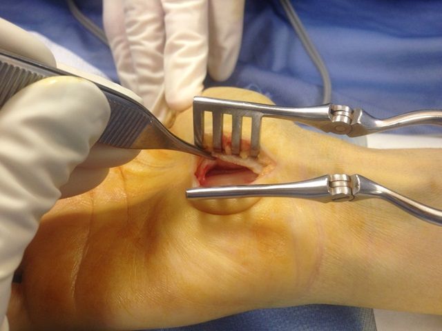 Lucian Lior Marcovici-4