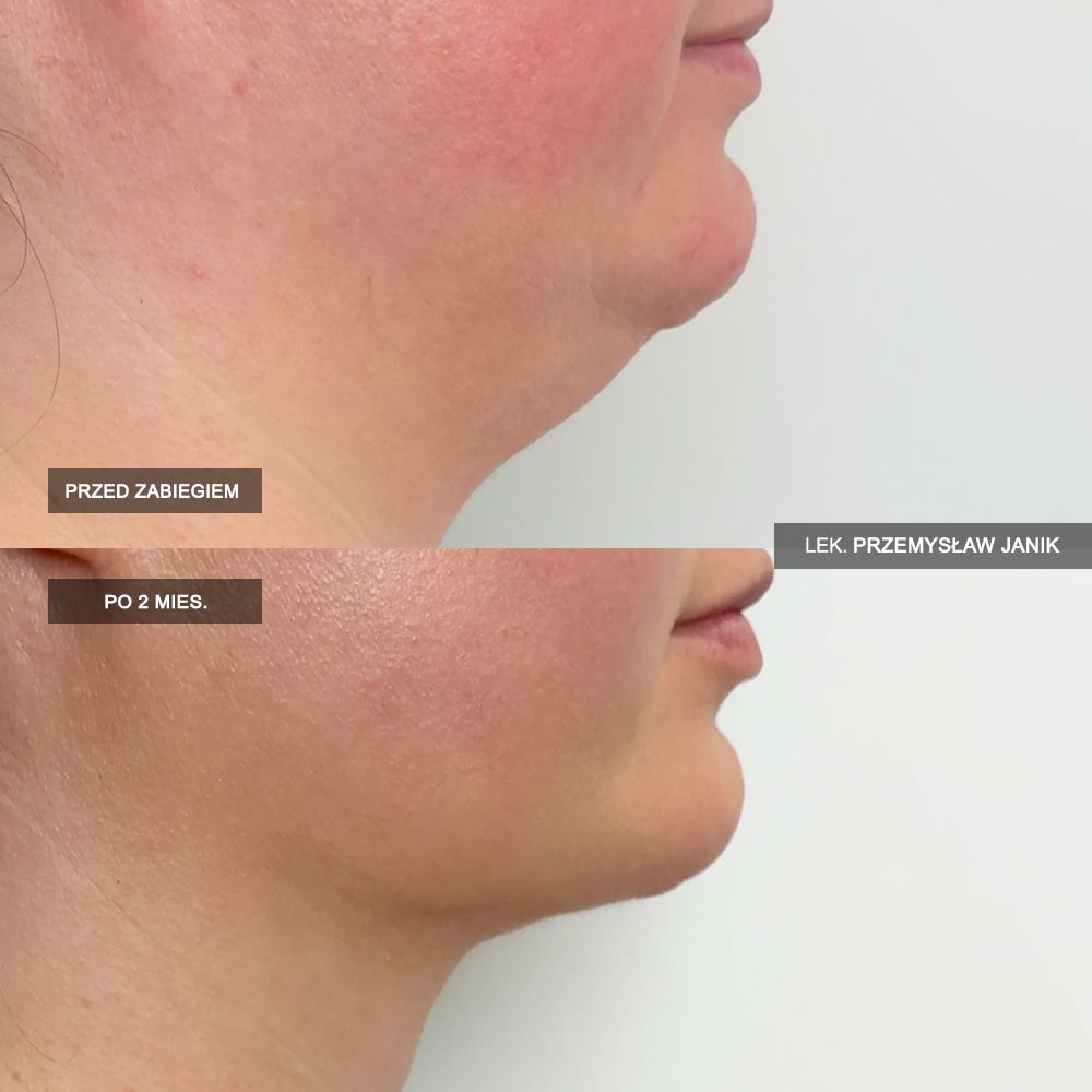 Przemysław Janik-30