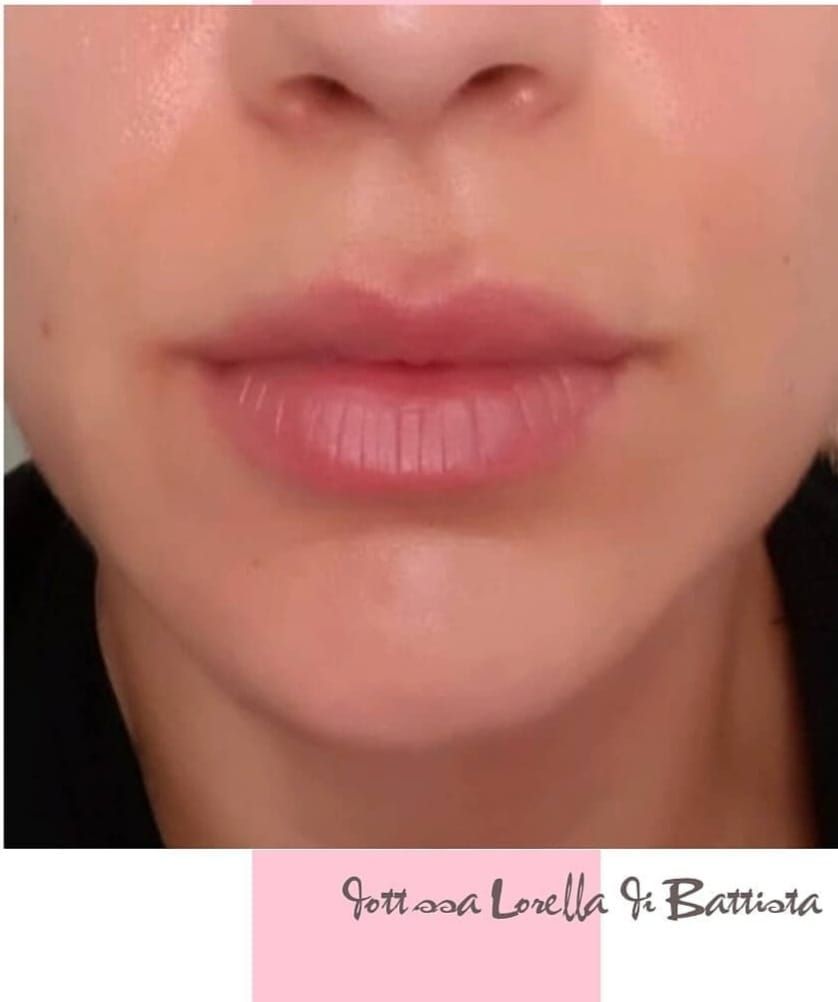 Lorella Di Battista-6