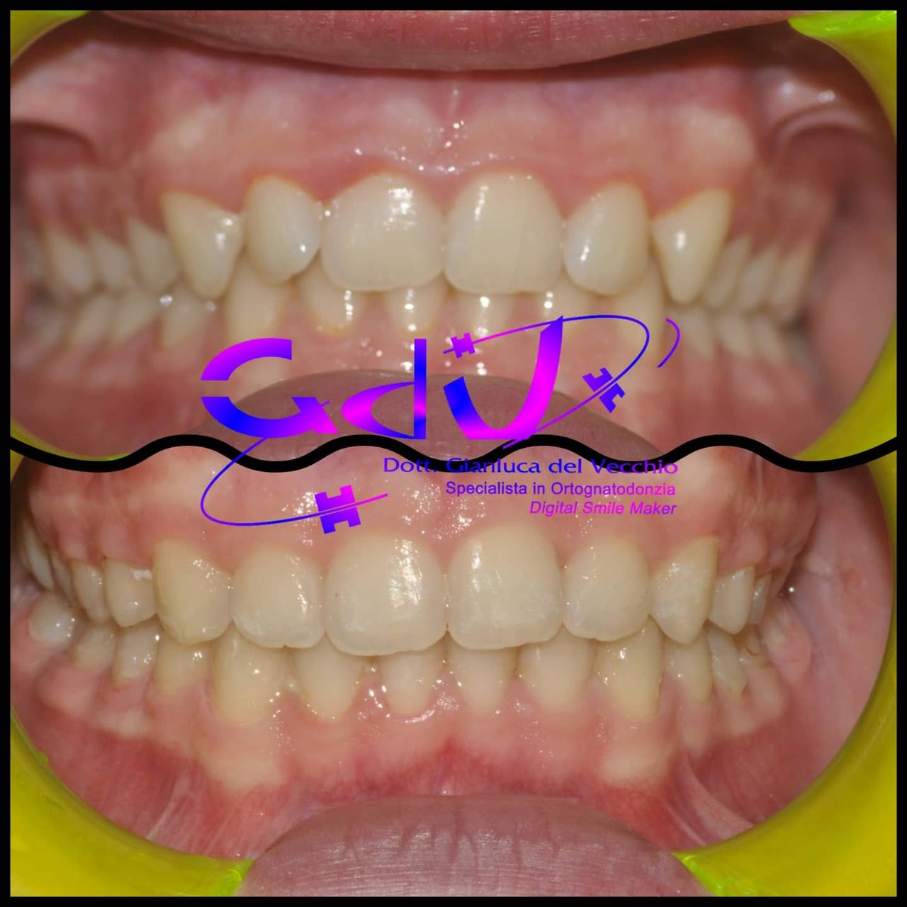 Gianluca Del Vecchio-166