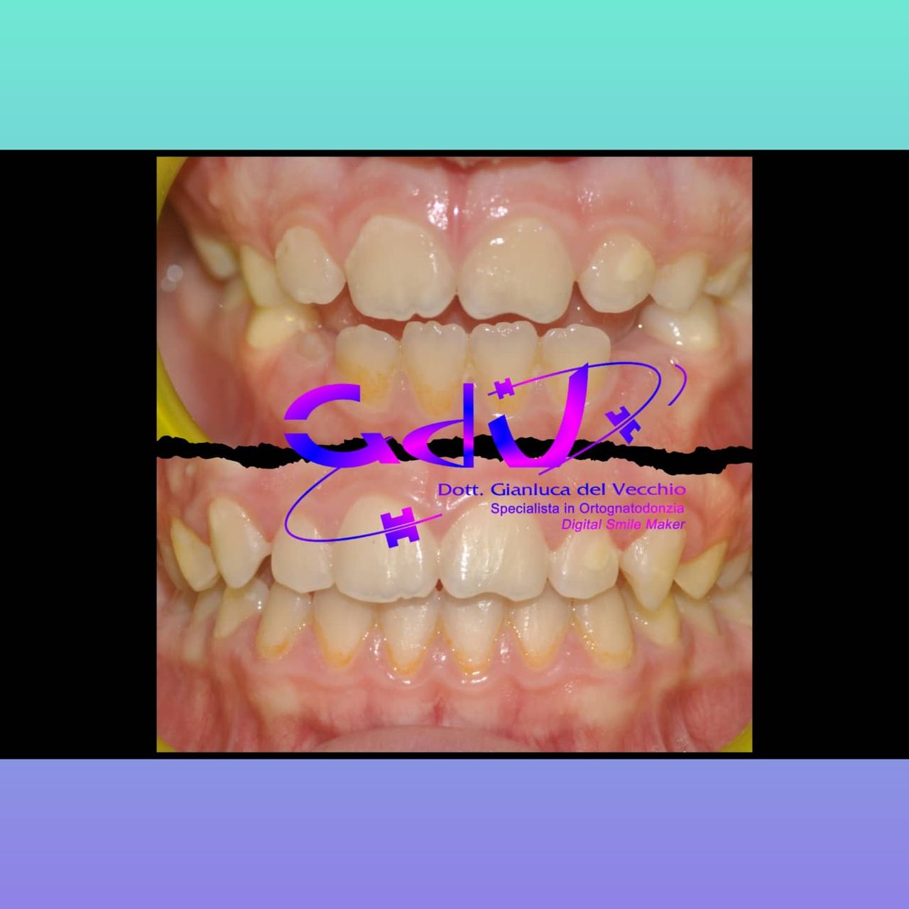 Gianluca Del Vecchio-149