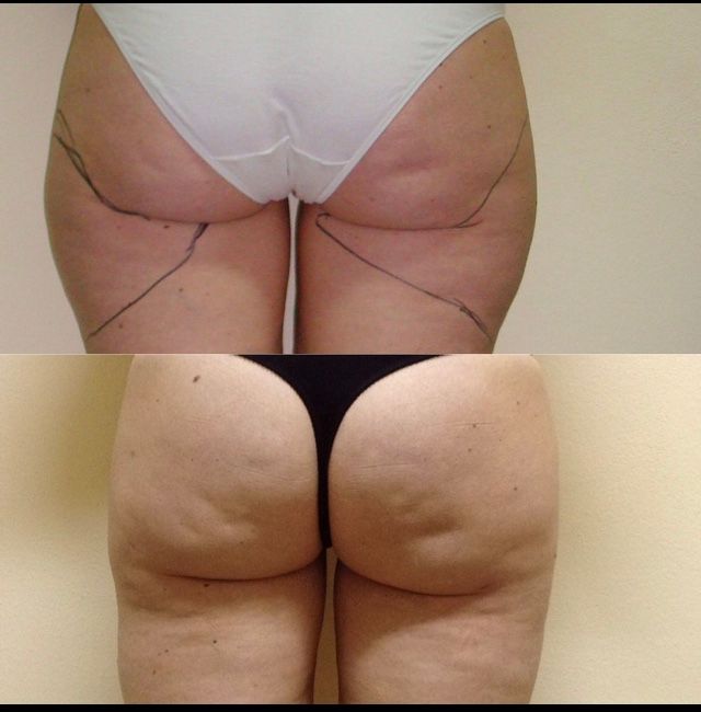 Virginia Cristina Rapisarda-92