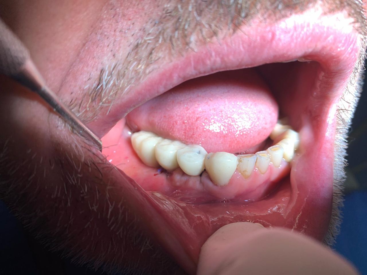 Stefano De Simone-46