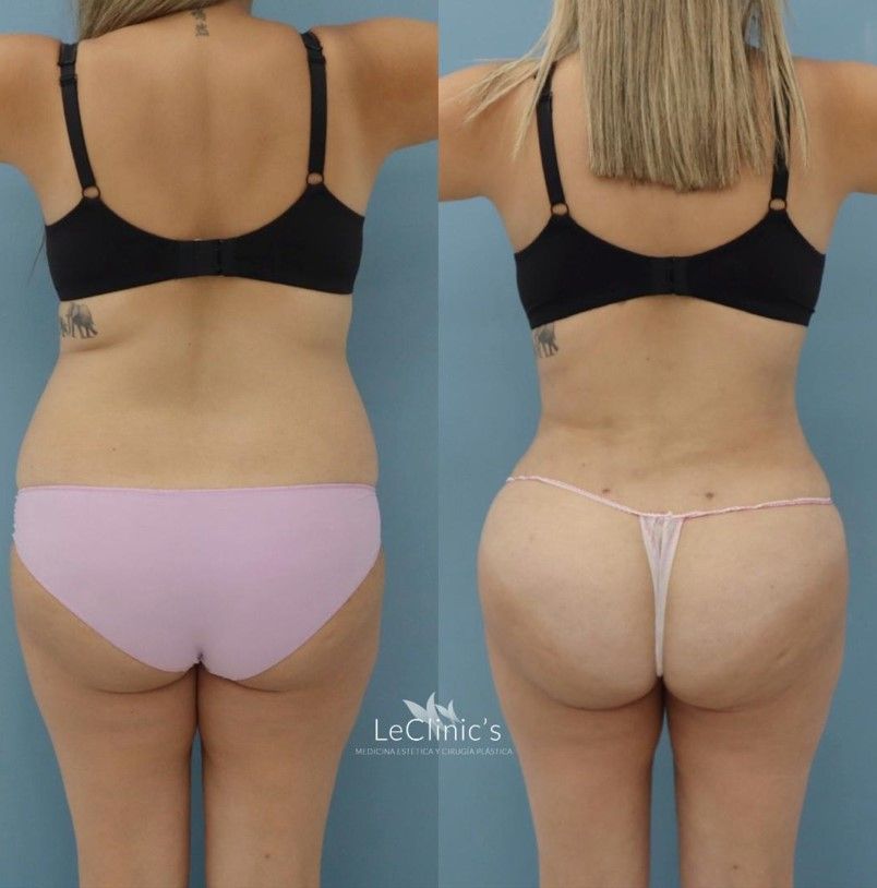 Carlos Corrales Benítez-6