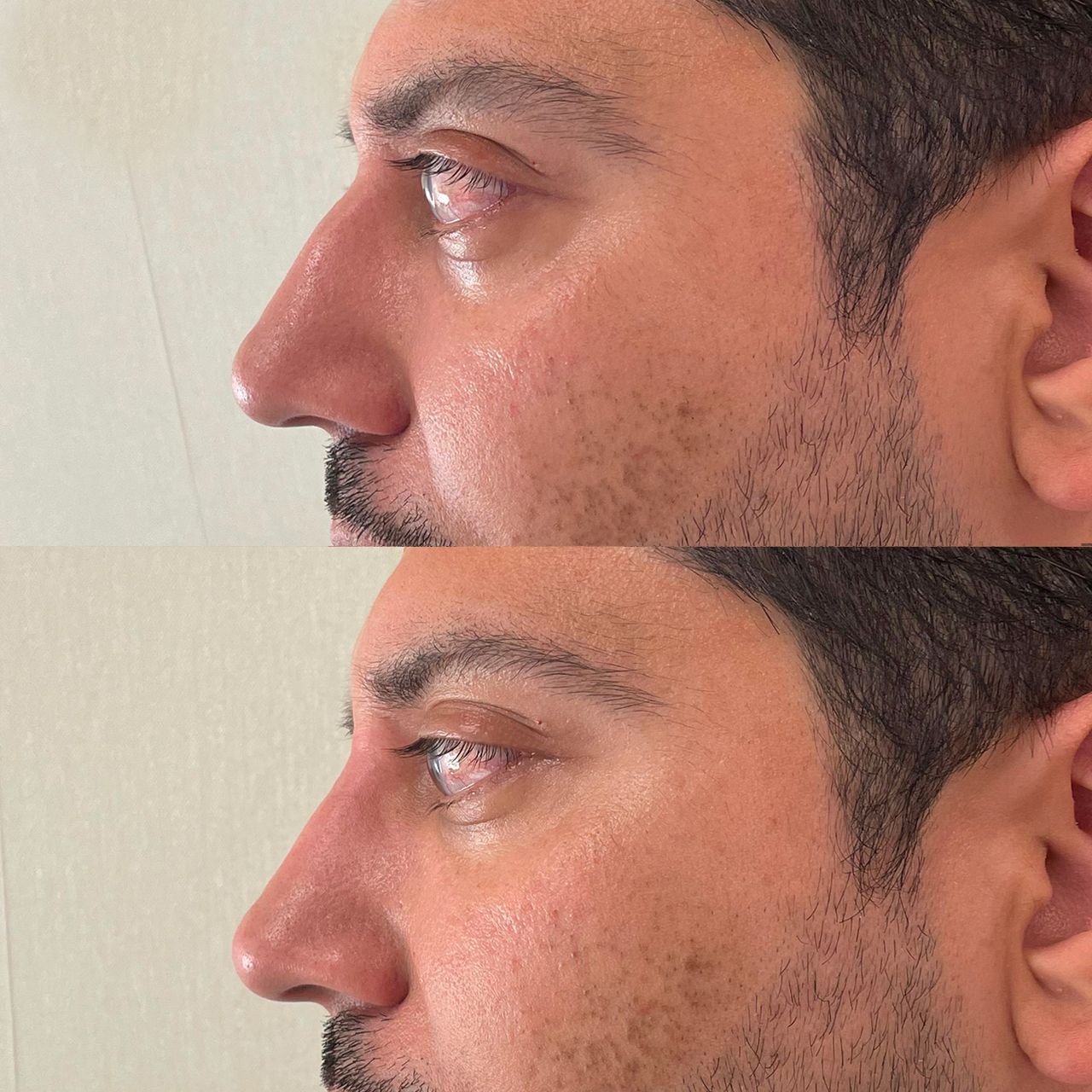 Marco Carmisciano-18