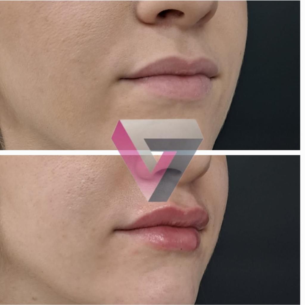 Victoria Trasmonte-49