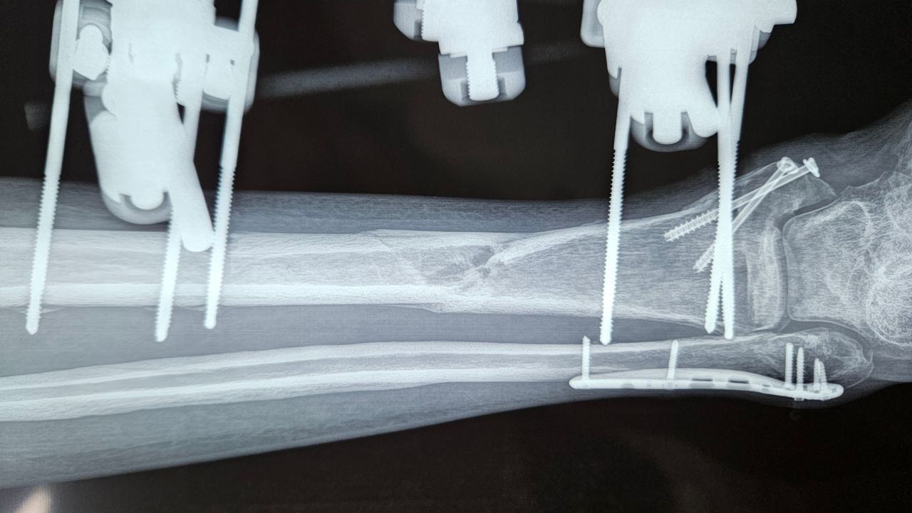 Gennaro Campopiano-16