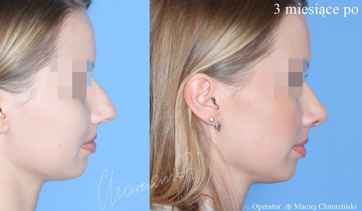 Maciej Charaziński-66