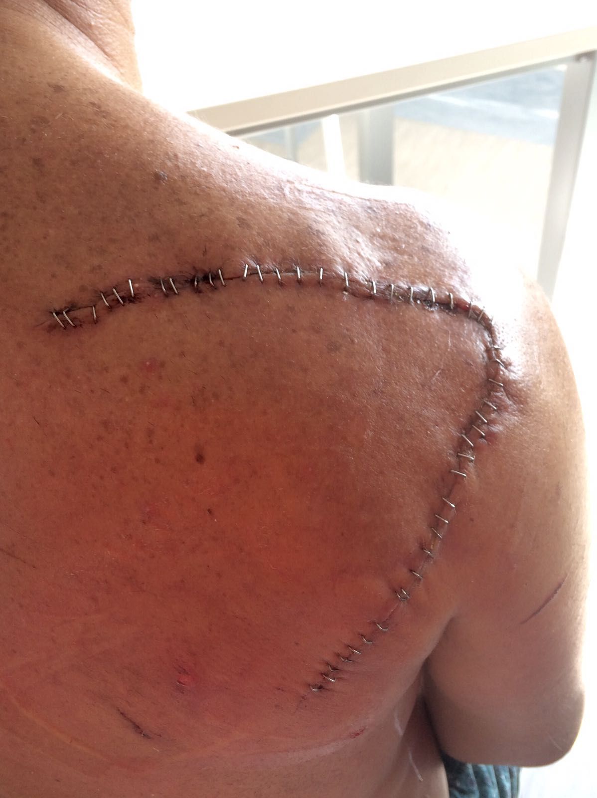 Giuseppe Lombardo-29