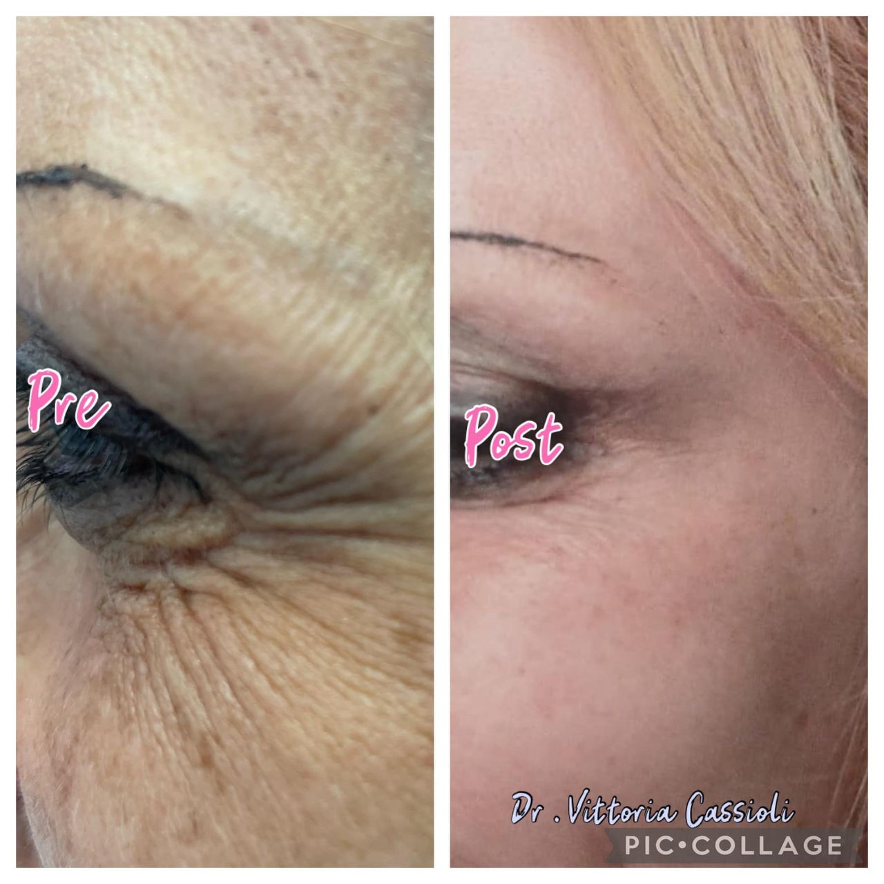 Vittoria Cassioli-69