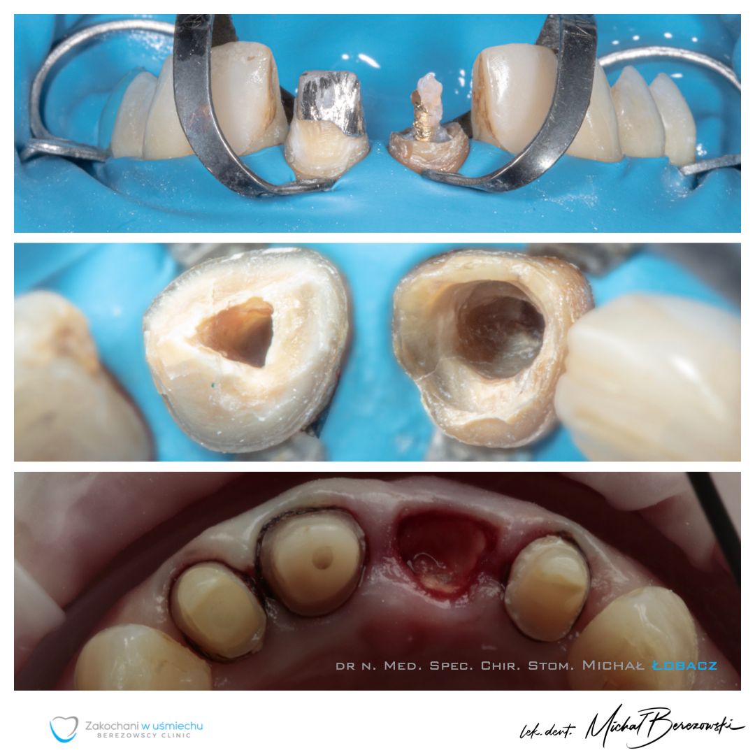 Michał Berezowski-30