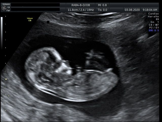 D'ambrosi Francesco-4