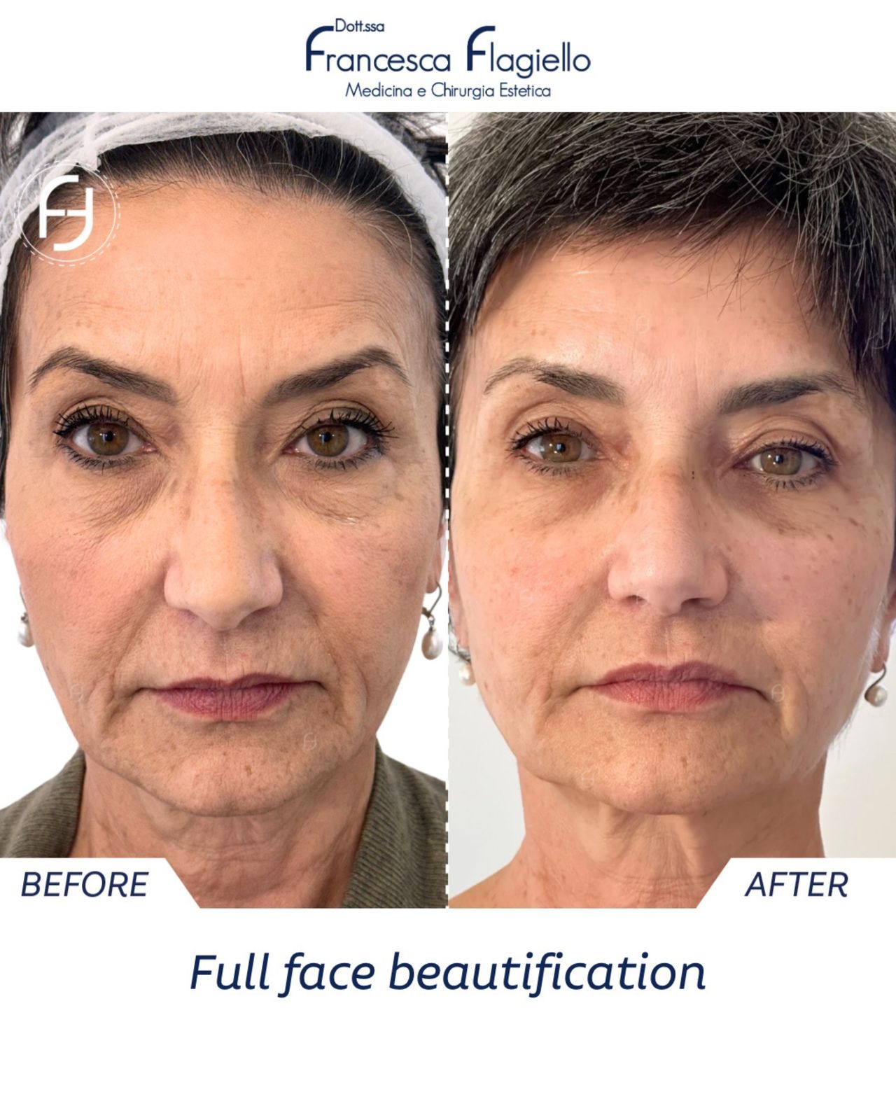 Francesca Flagiello-9