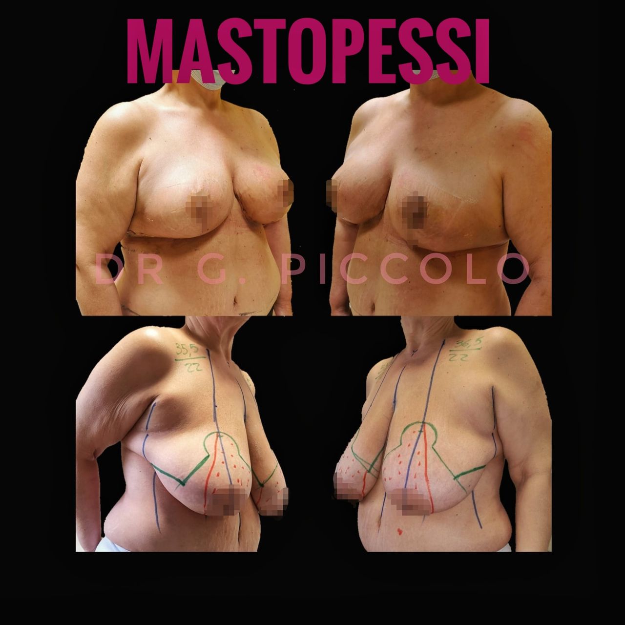 Giuseppina Piccolo-50