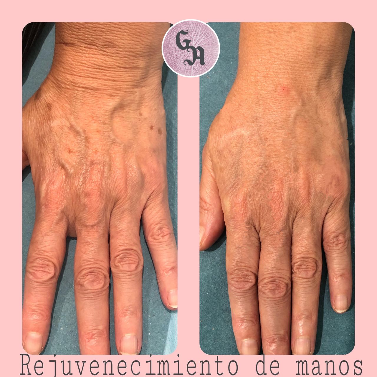 Gracia Alonso Rosales-10