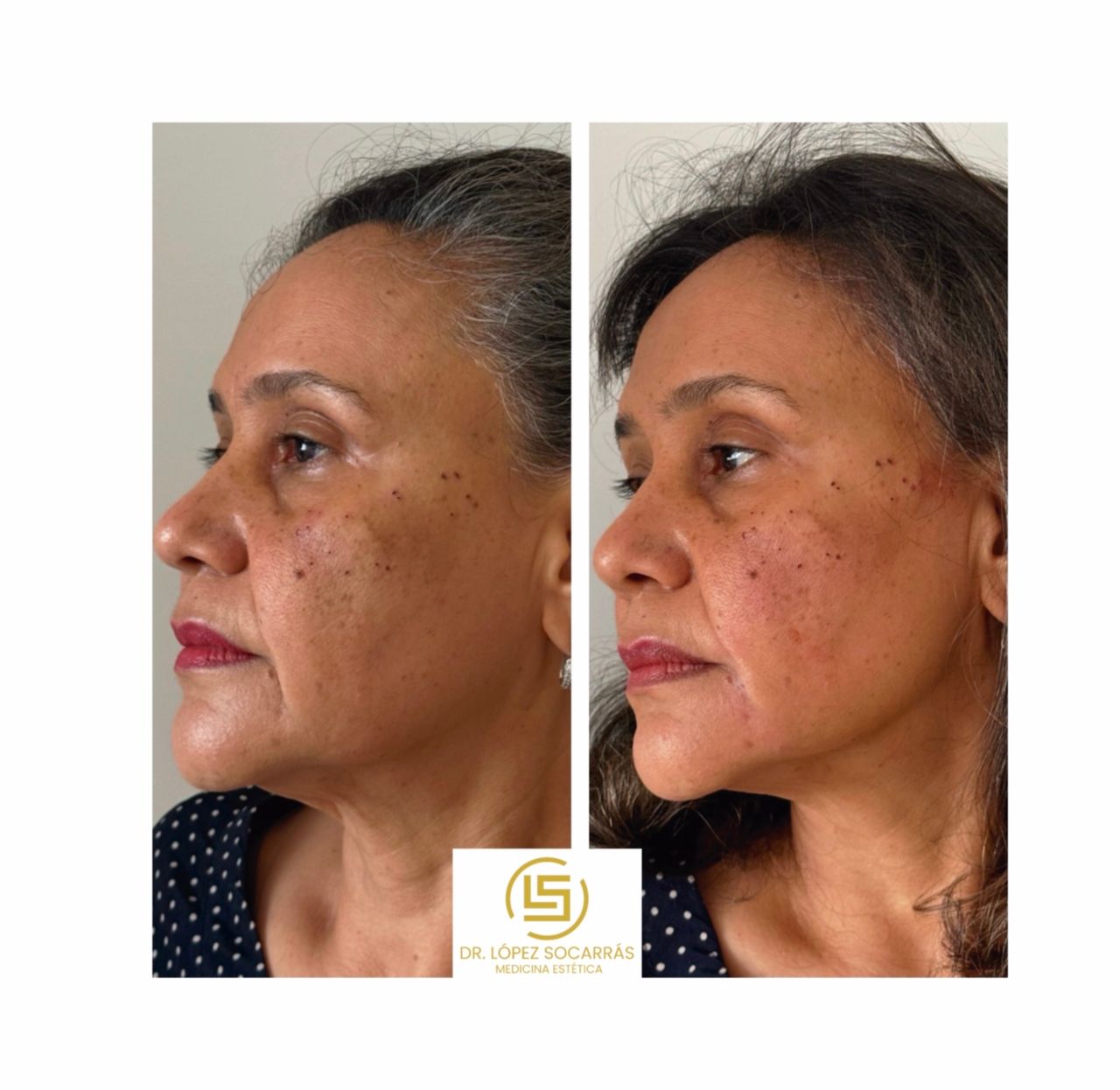 Camilo López Socarrás-3