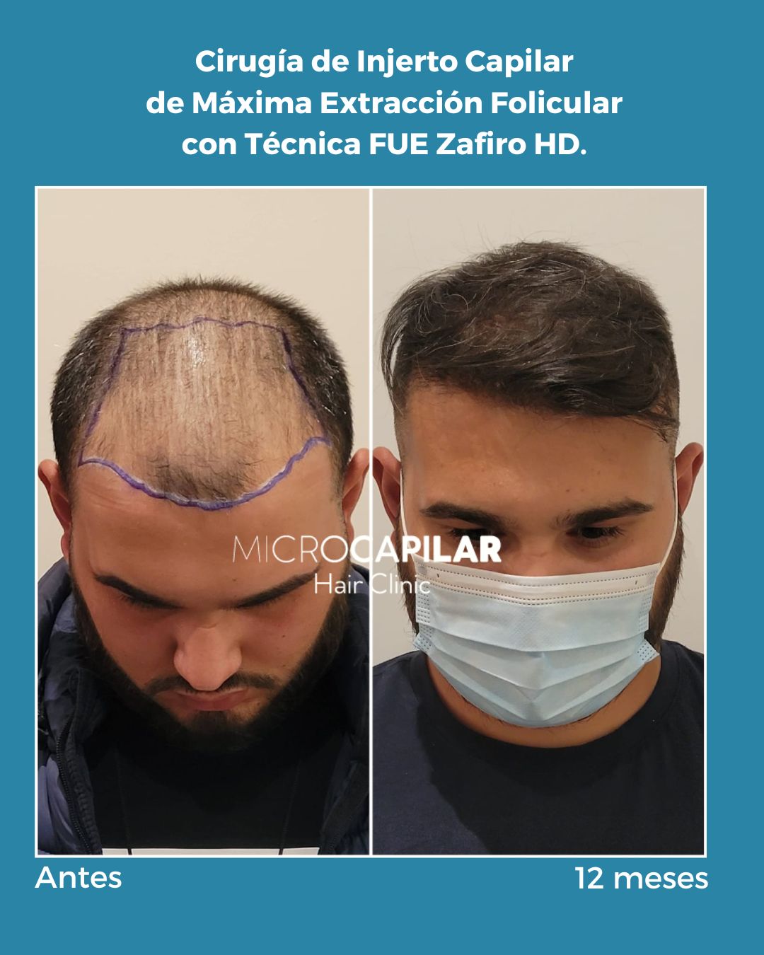 Antonio Fernández Brito-8