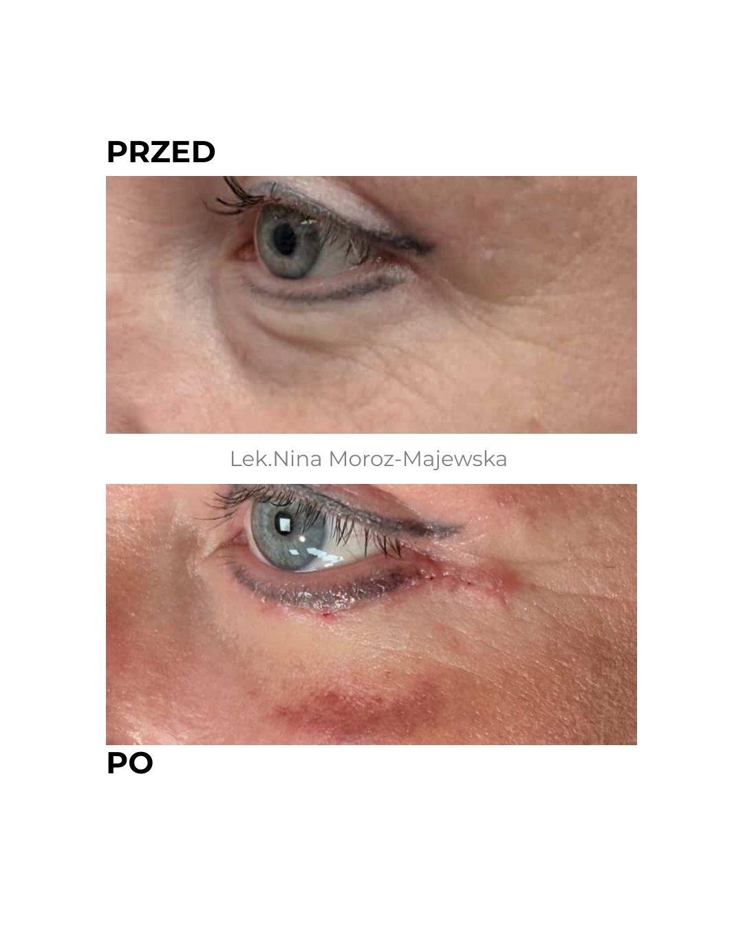 Nina Moroz-Majewska-0
