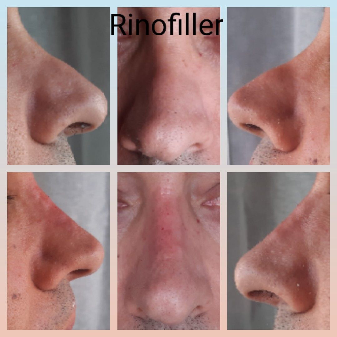 Paola Della Rocca-25