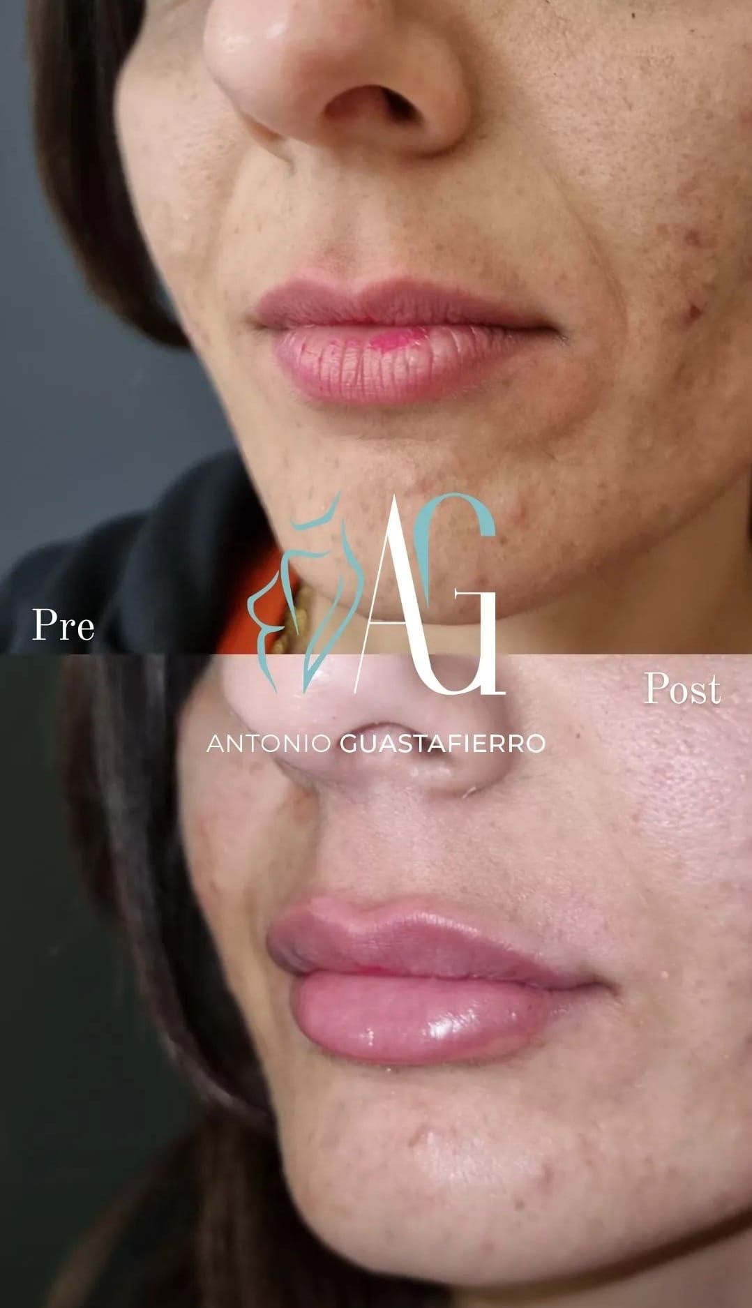 Antonio Guastafierro-10