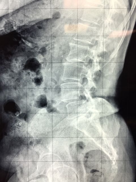 Massimo Brandolin-19