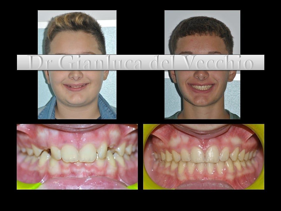 Gianluca Del Vecchio-47