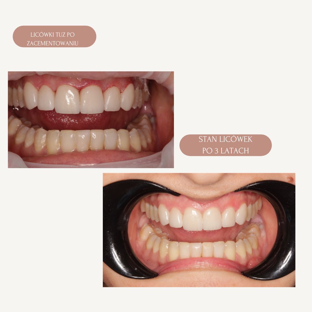 Elżbieta Zalewska-3