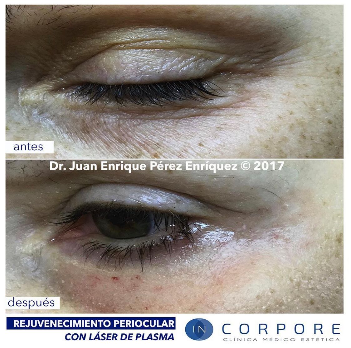 Juan Enrique Pérez Enríquez-103