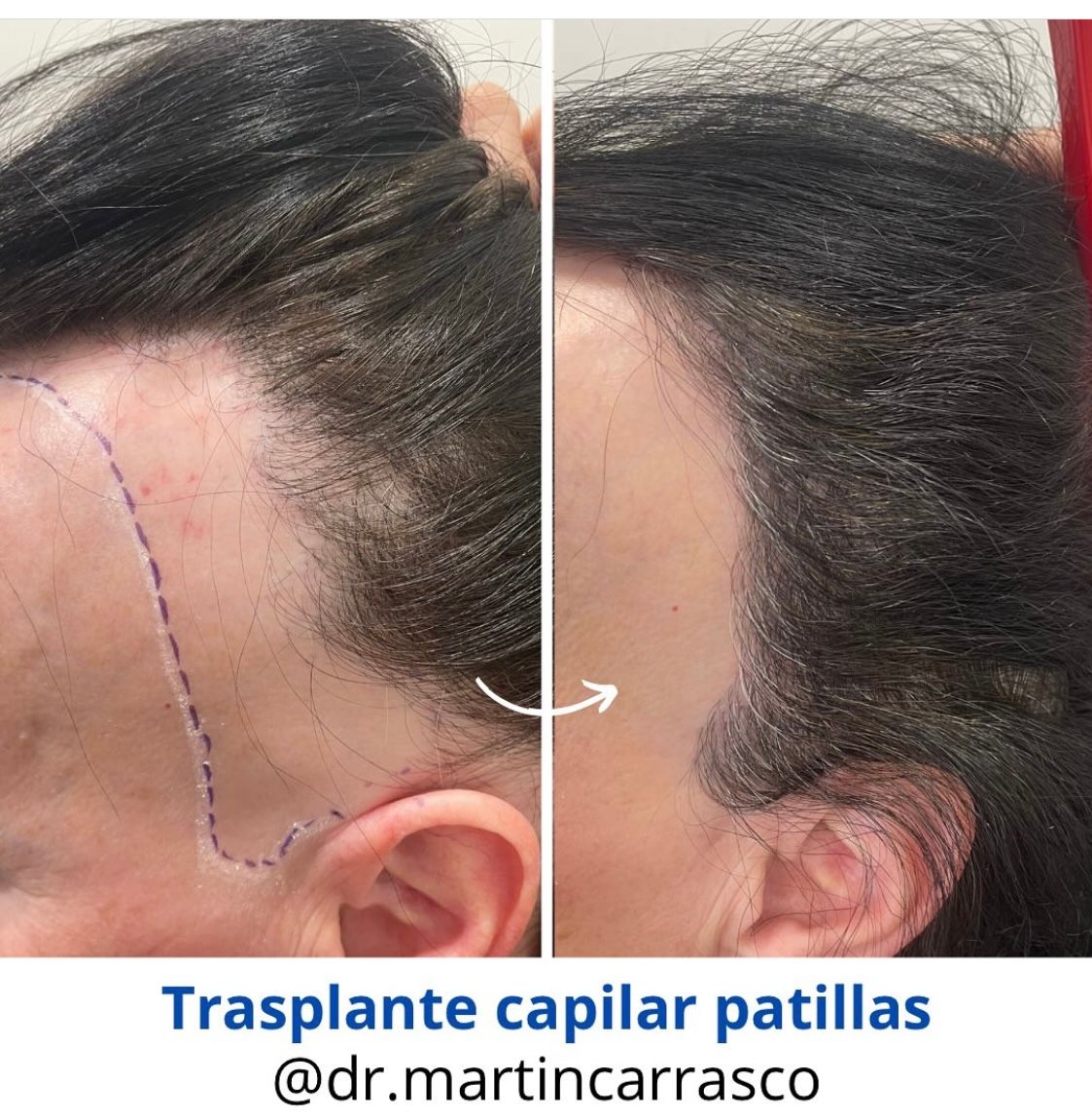 Pablo Martín Carrasco-8