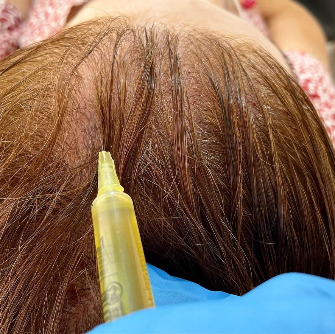 Juan Enrique Pérez Enríquez-3