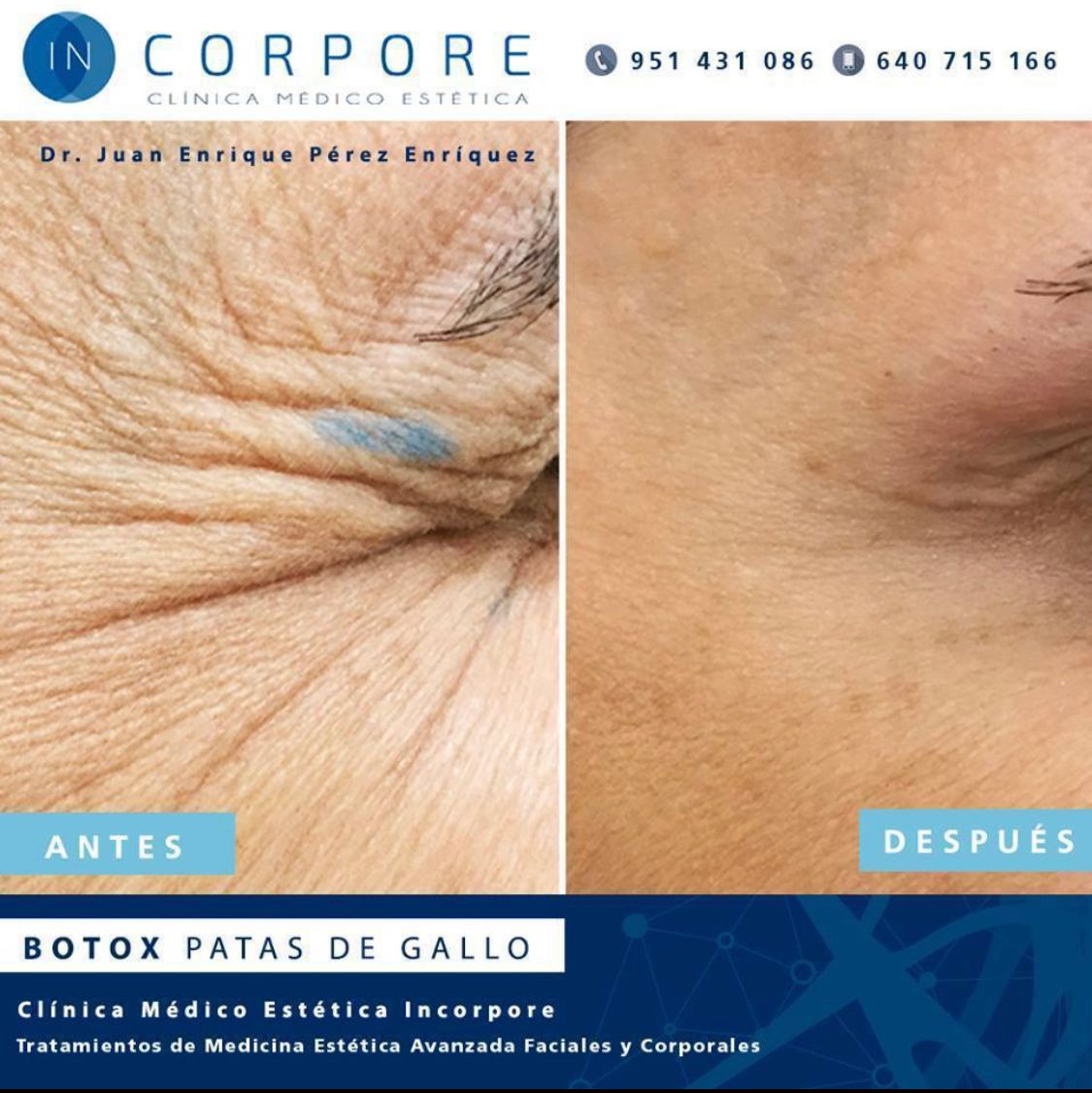 Juan Enrique Pérez Enríquez-113