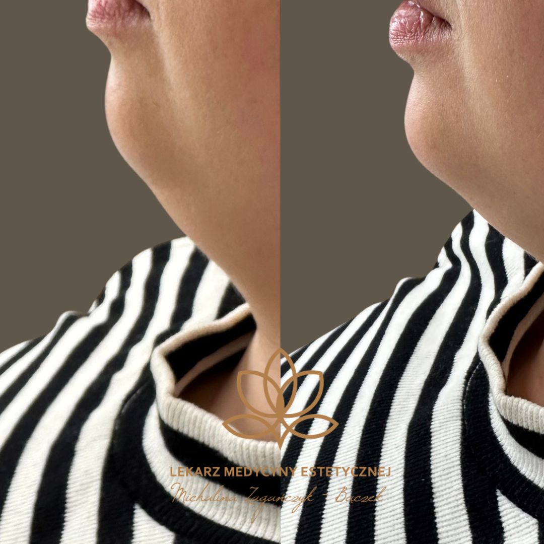 Michalina Zagańczyk-Bączek-22