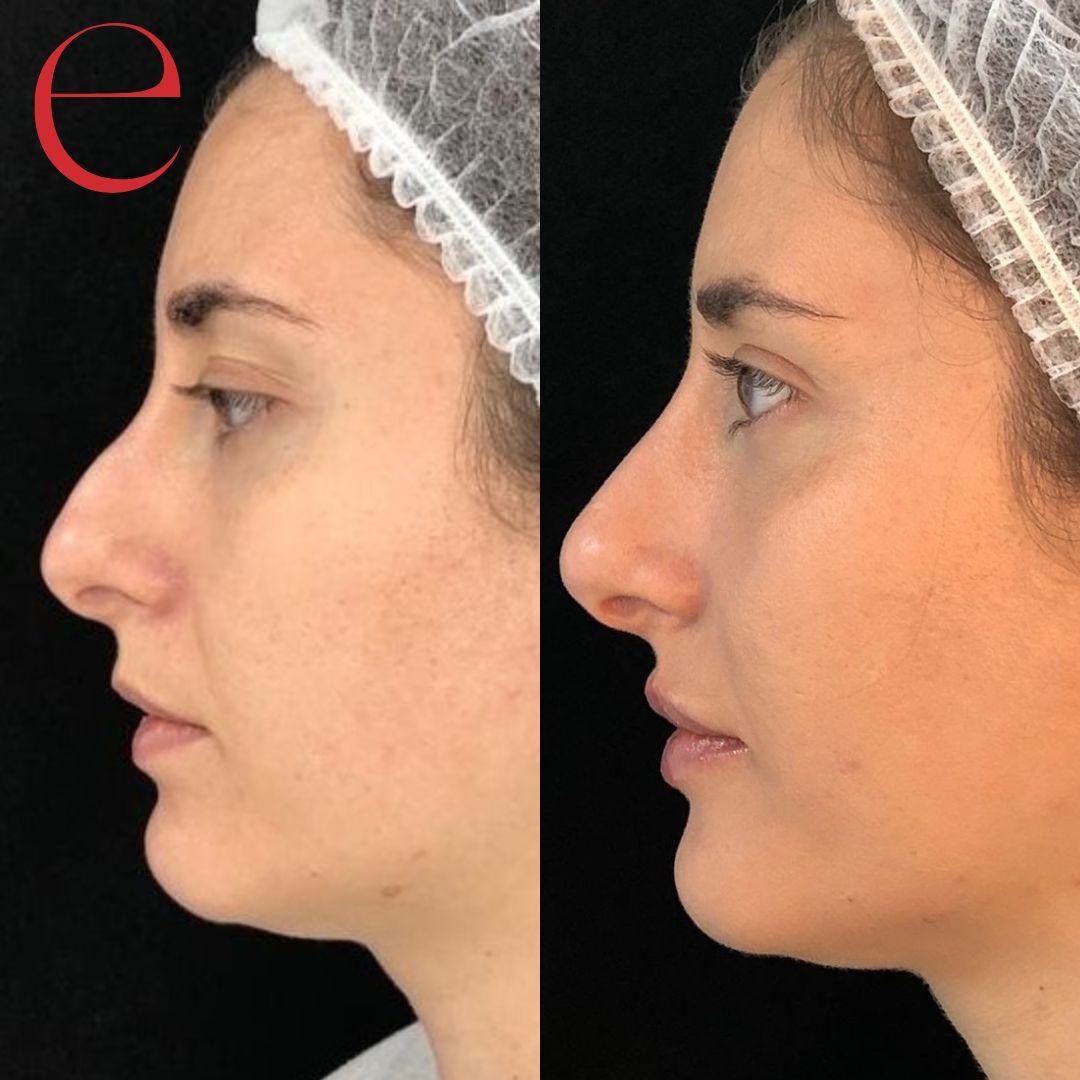 Raquel Moreno Pentinel-91