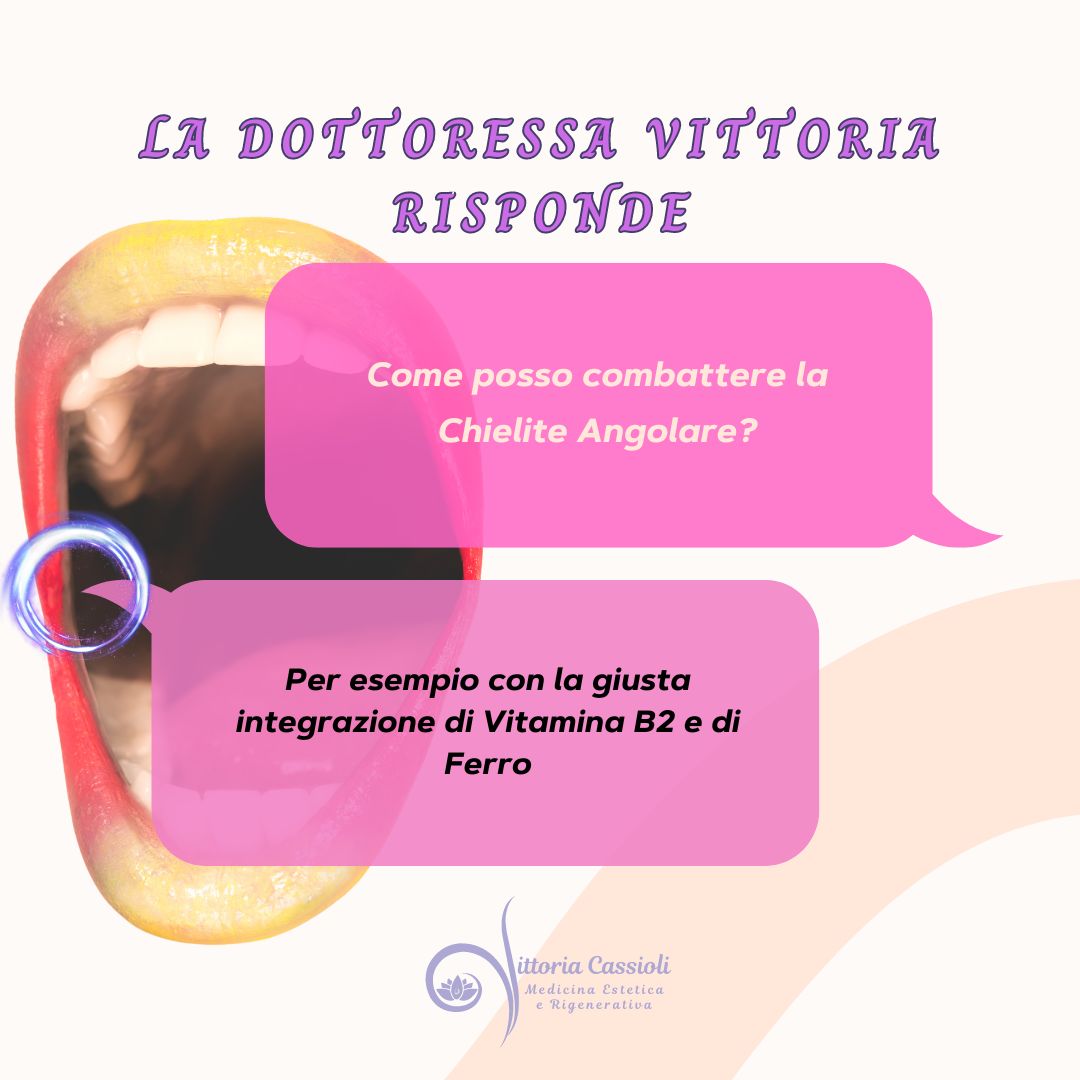 Vittoria Cassioli-48