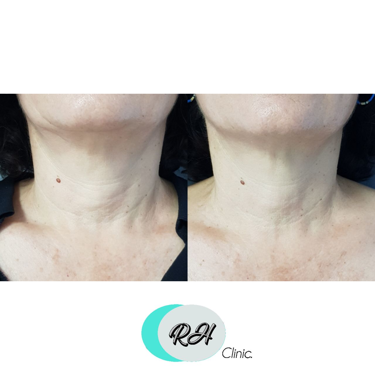 Rosalba Herrero Zerpa-75