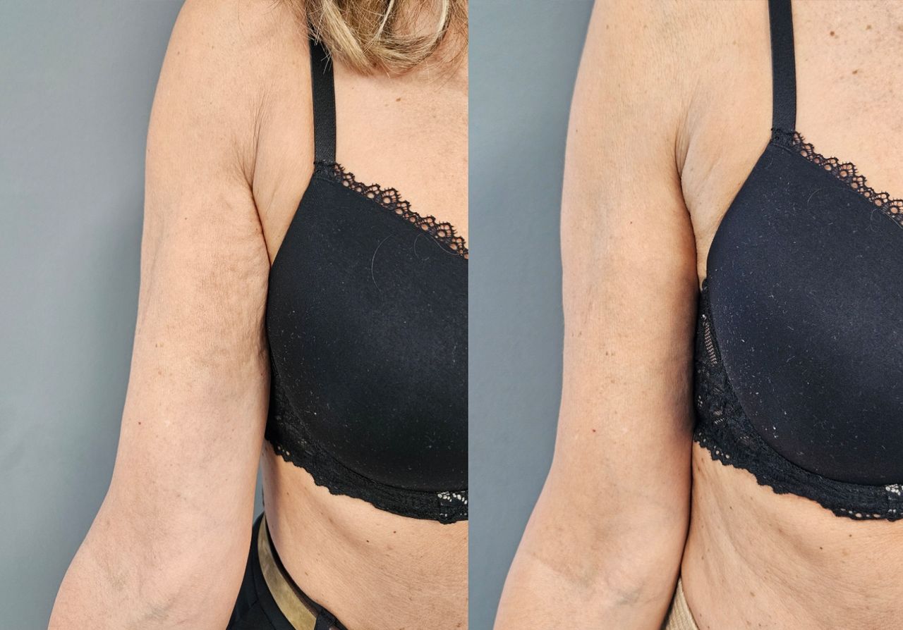 Rosalba Herrero Zerpa-550