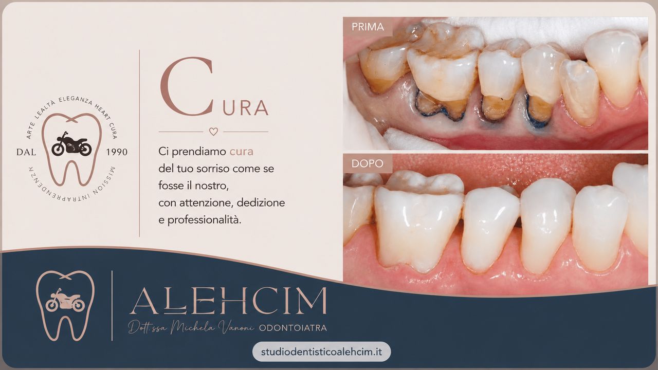 Michela Vanoni-4