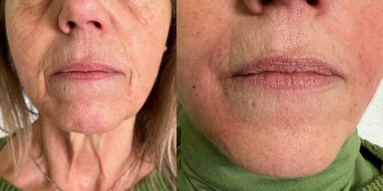 Jacopo Pettinelli-24