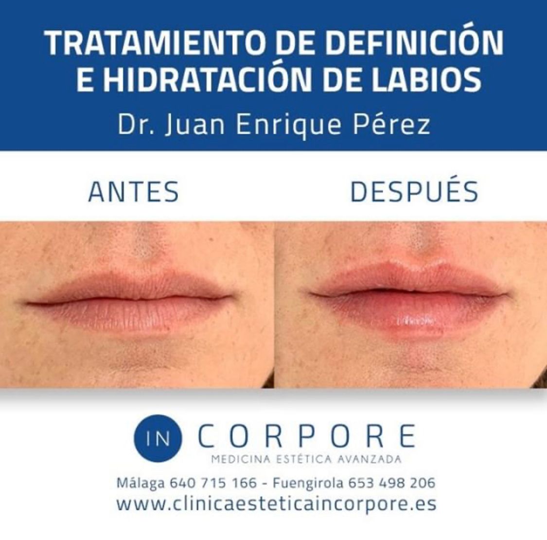 Juan Enrique Pérez Enríquez-86